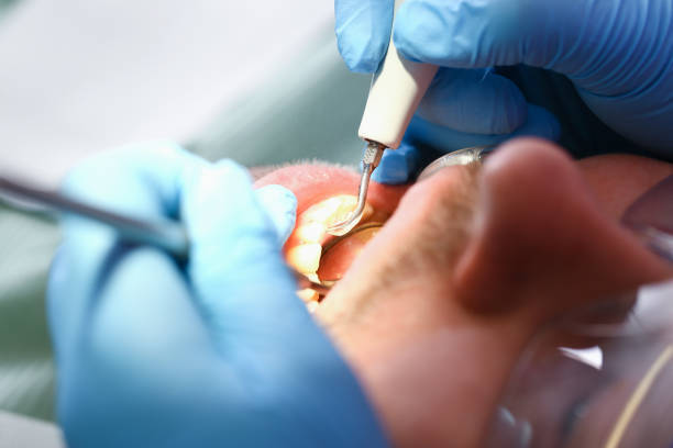Best Emergency Denture Repair in Hinckley, MN